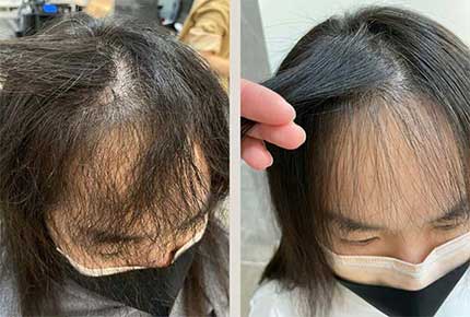 對抗自然捲、毛燥髮大作戰！